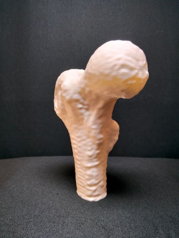 Fémur — modelo físico 3D